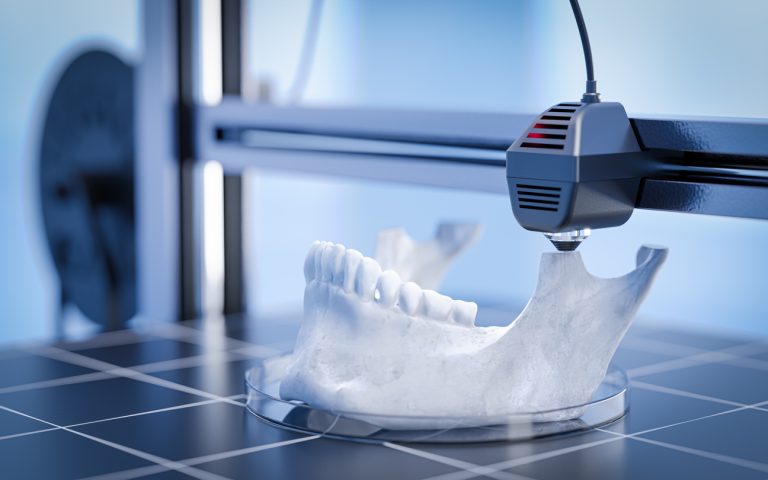 druk 3D w stomatologii, druk 3D w protetyce